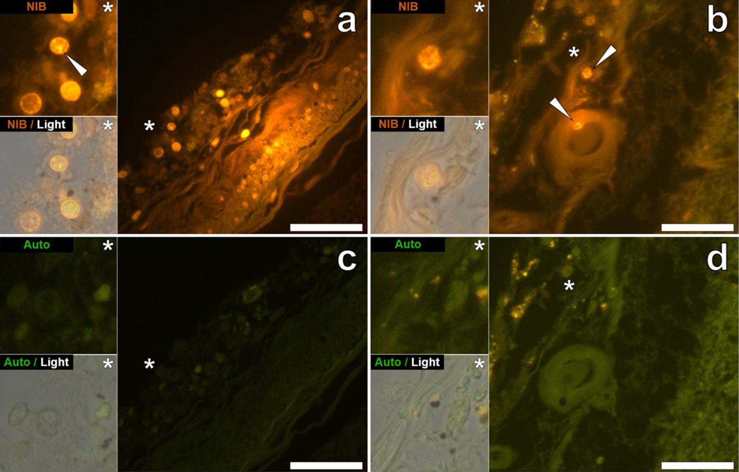 lumogallion-staining